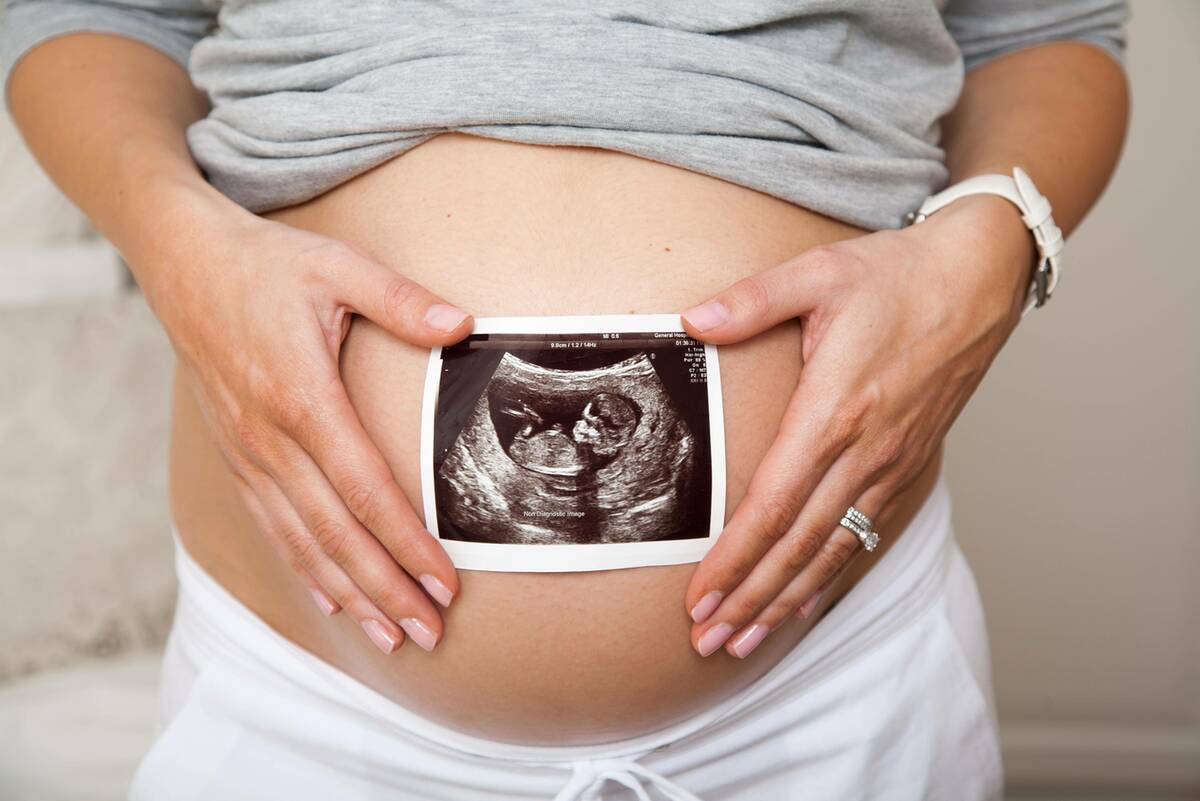 womans pregnant belly and ultrasound
